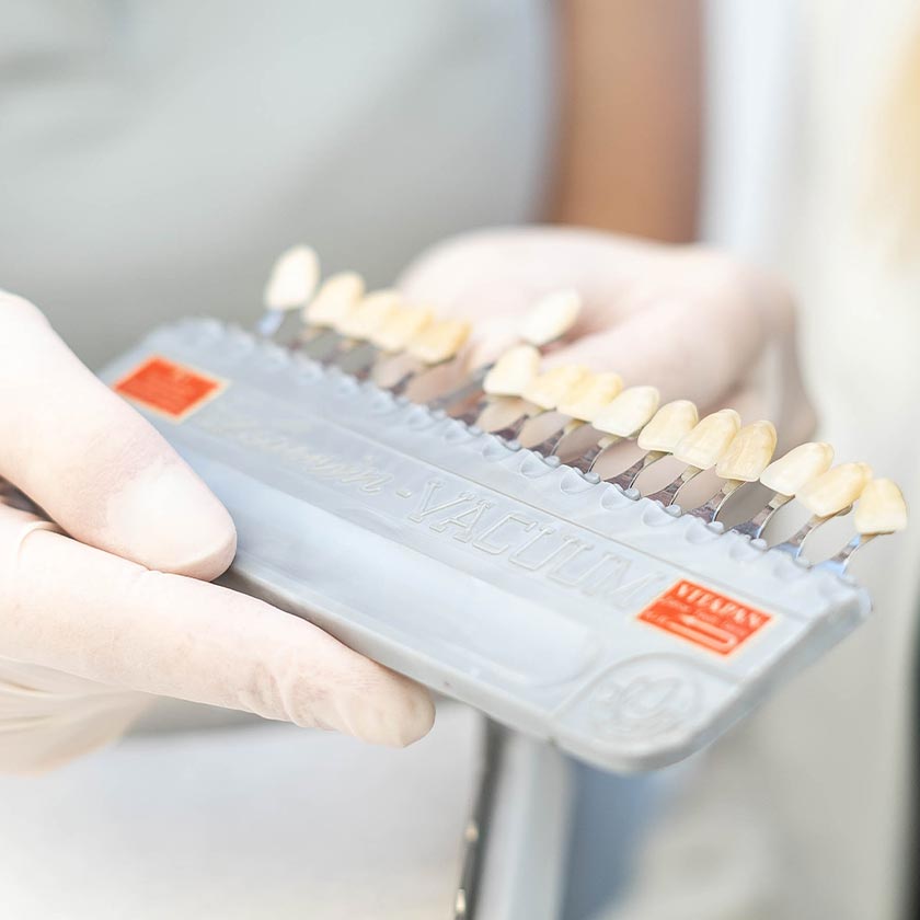 dr wiens zahnarzt eppelheim behandlungsspekturum teaser bleaching