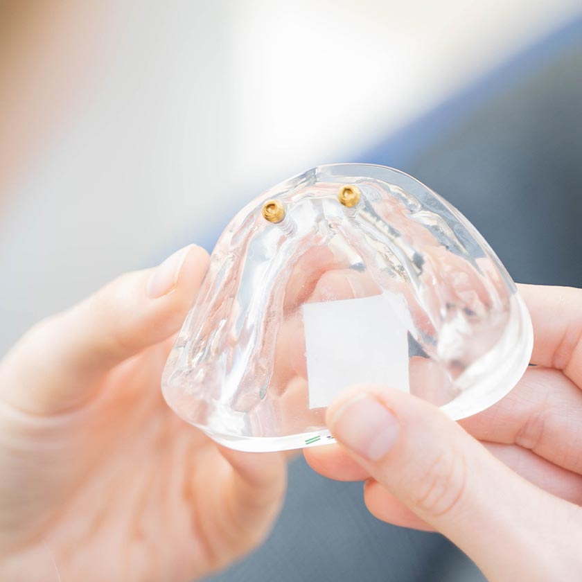 dr wiens zahnarzt eppelheim behandlungsspekturum teaser implantate